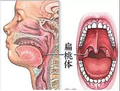 扁桃体剖析图
